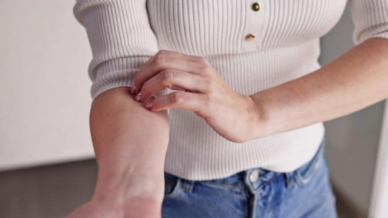 Kobieta w białym swetrze i niebieskich dżinsach drapie się po przedramieniu, co może sugerować swędzenie skóry lub reakcję alergiczną.