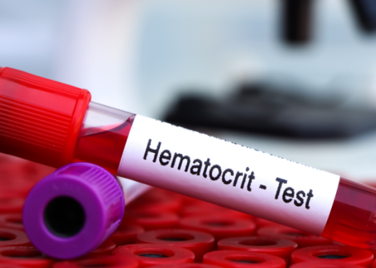 Hematokryt – co oznacza i dlaczego jest tak ważny?
