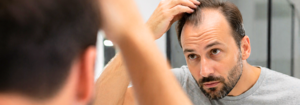 Kiedy zdecydować się na przeszczep włosów? Kluczowe czynniki i optymalny wiek