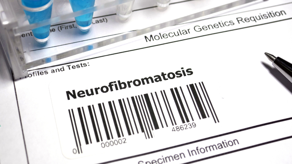 Dokumentacja genetyczna z oznaczeniem neurofibromatozy – badania DNA i diagnoza choroby genetycznej