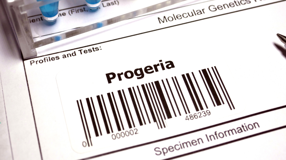 Etykieta laboratoryjna z napisem "Progeria" i kodem kreskowym na formularzu testu genetycznego