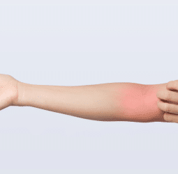 Ból przedramienia nie daje ci spokoju? Sprawdź, co naprawdę może za nim stać