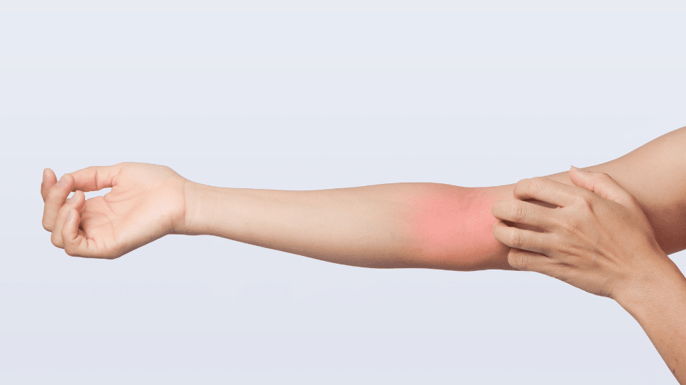 Ból przedramienia nie daje ci spokoju? Sprawdź, co naprawdę może za nim stać