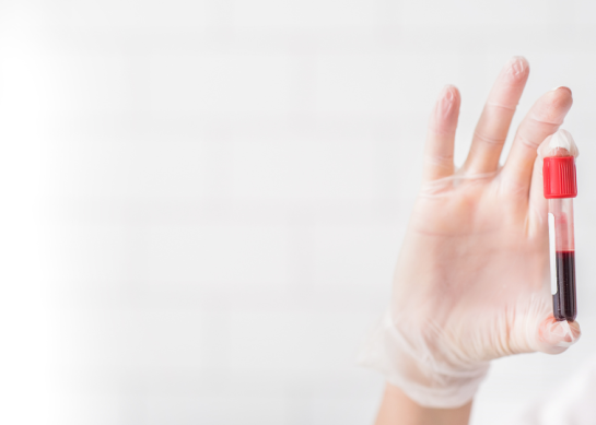 Co to jest RDW-SD? Norma, interpretacja wyników i kiedy może niepokoić?