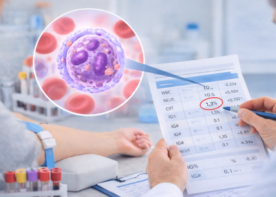 Wynik IG co oznacza? Norma, przyczyny i kiedy jest niepokojący